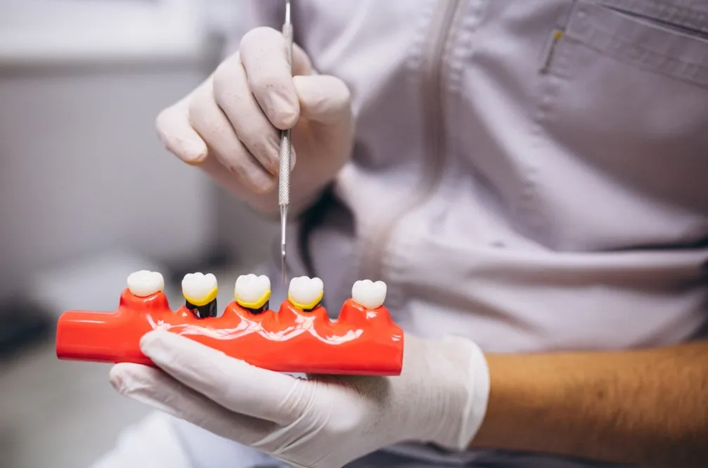 How to Choose Zirconia Crowns for Damaged or Weakened Teeth