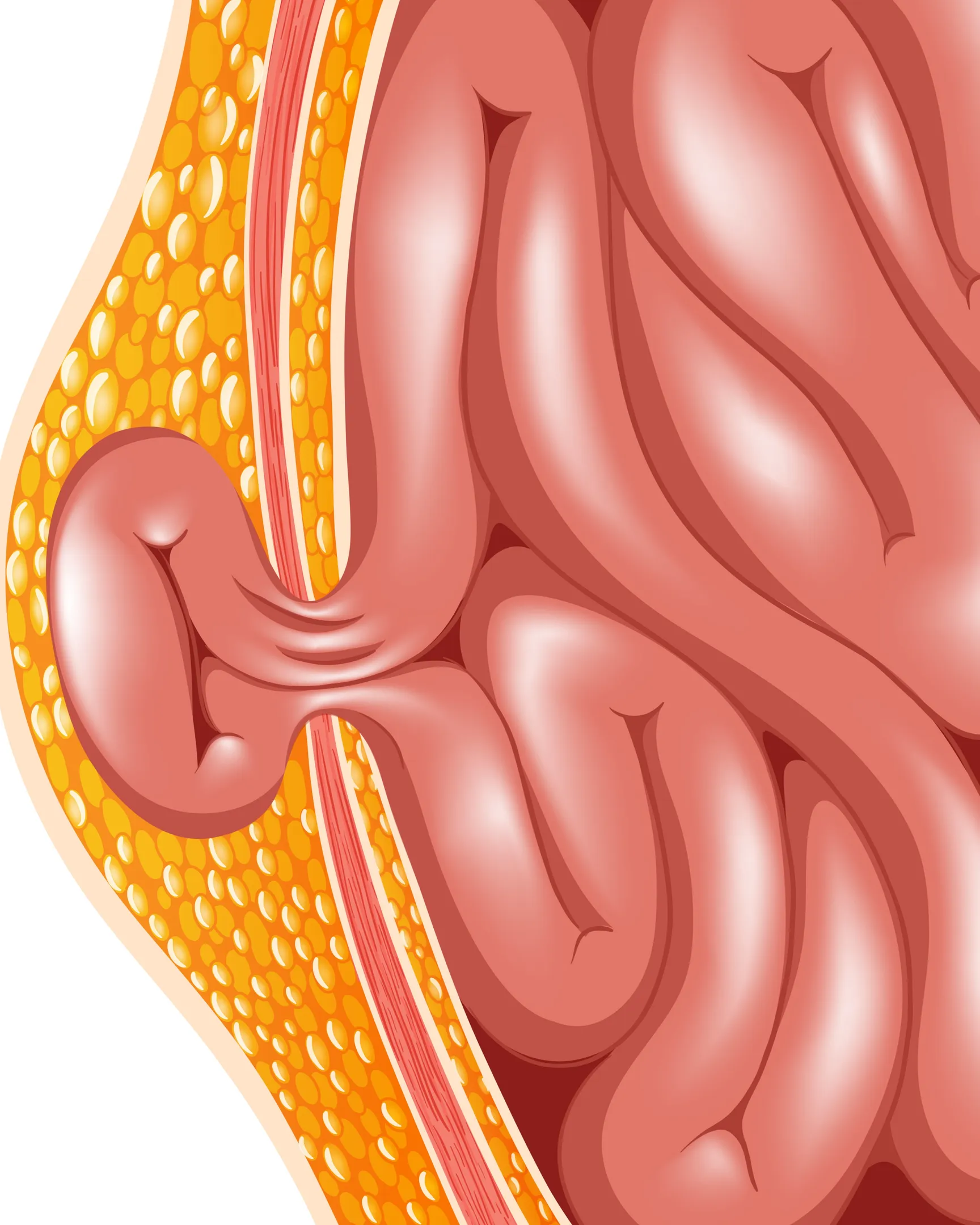 Early Signs That May Require a Hernia Treatment Specialist in Thane