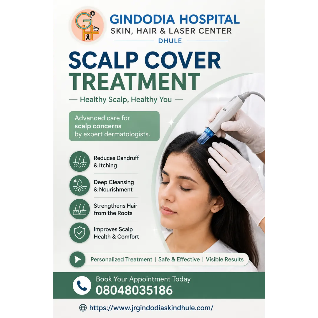 Scalp Cover Treatment in Dhule | Gindodia Hospital