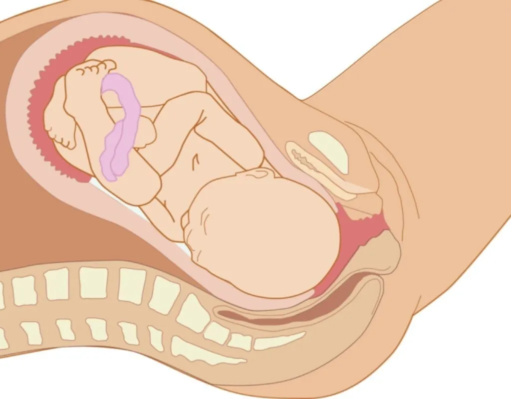 Comprehensive Maternity Support in Hinjewadi, Wakad, PCMC
