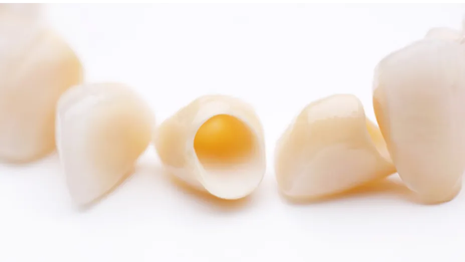 Fully Ceramic Crown Cap or Other Dental Crowns? How to Choose the Right Option in Viman Nagar