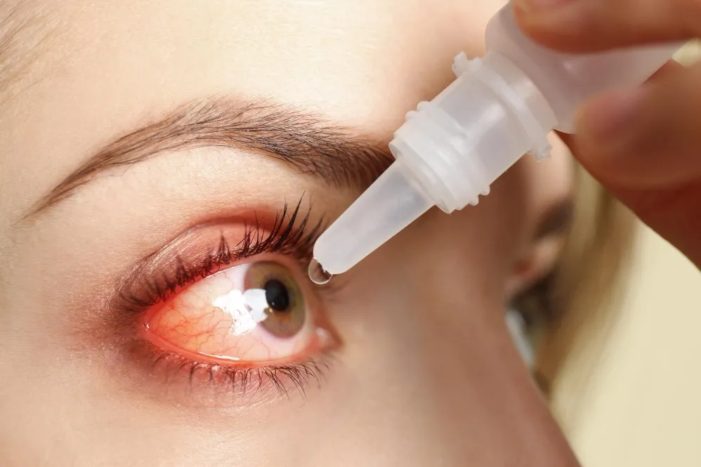 When to Seek Redness Treatment in Grant Road Instead of Using Home Remedies