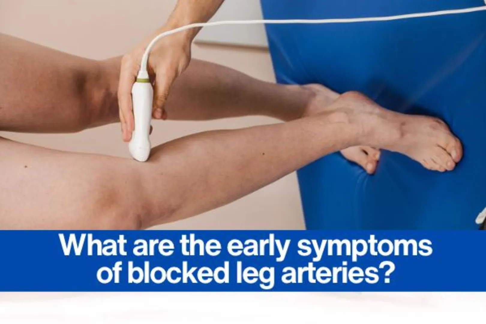 What are the early symptoms of blocked leg arteries?