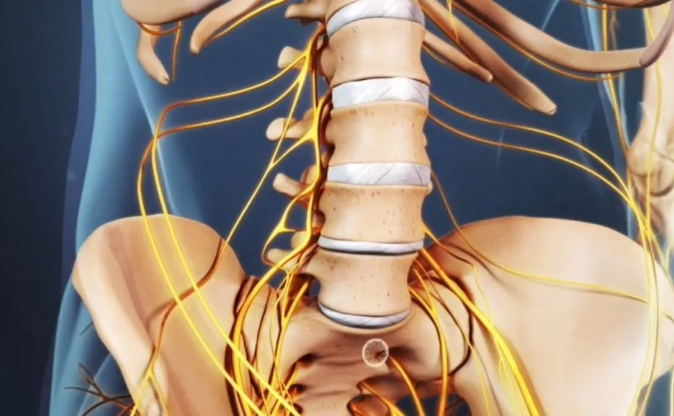 Best Sciatica Treatment Specialist in Pune |