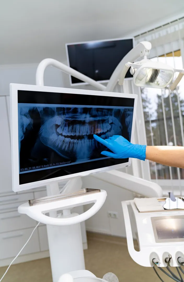 How Digital Dental X-Rays Help Dentists Detect Problems Earlier