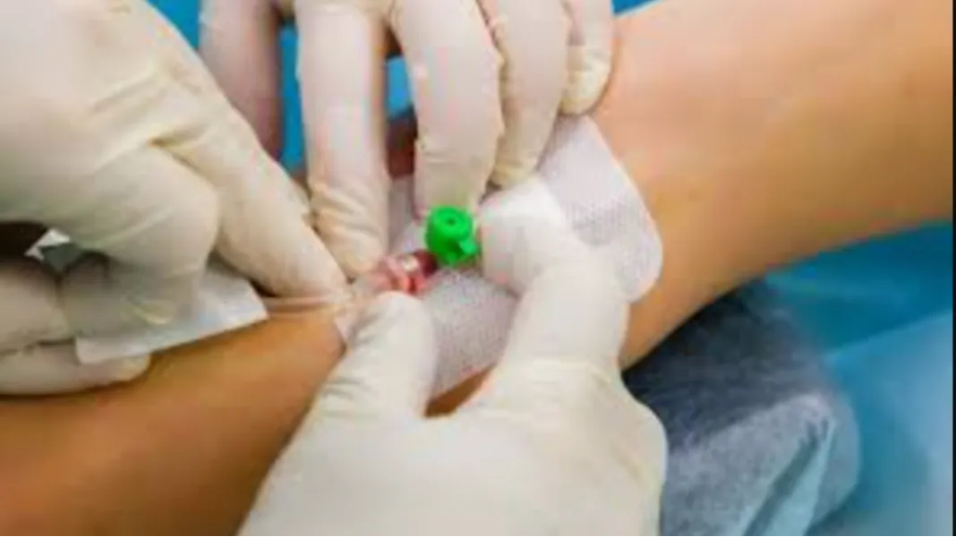 Vascular Access Planning for Dialysis: What Pune Patients Should Know Before Hemodialysis