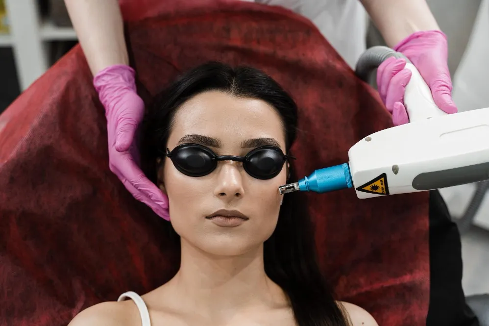 When Laser Treatment for Pigmentation May Be Considered for Dark Spots
