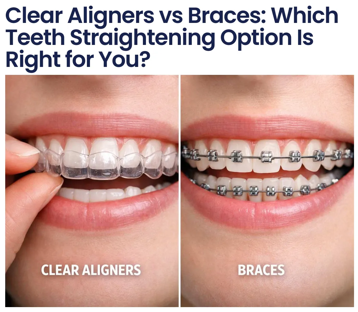 Braces vs Clear Aligners: Which Is Better for Straightening Your Teeth?
