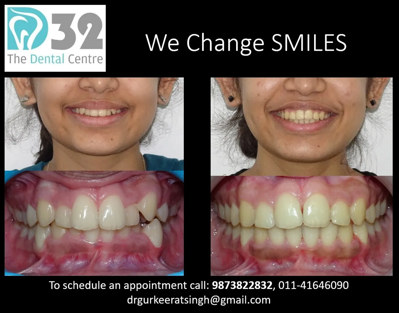 A Change in Smile Can Change Much More