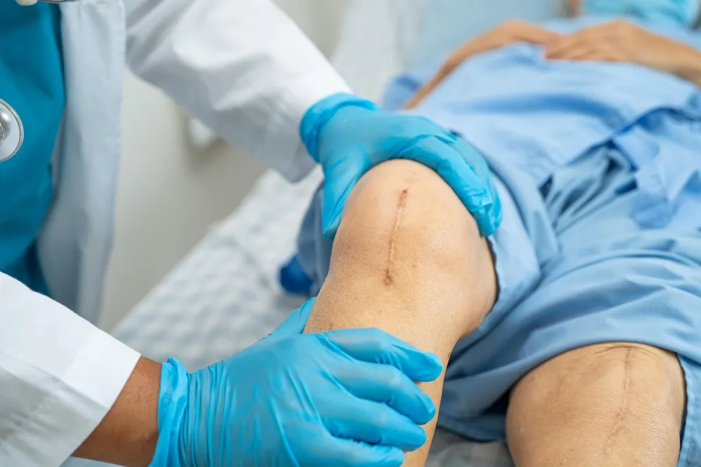 Joint Replacement Surgery for Severe Knee and Hip Arthritis in Bengaluru