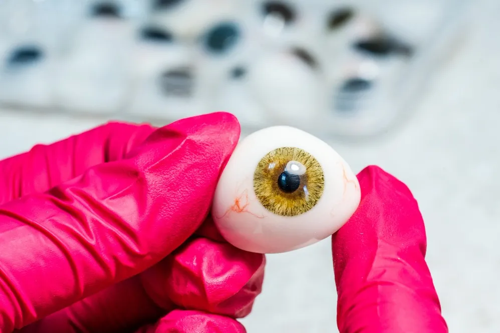 Prosthetic Eye Solutions Restore Facial Appearance After Eye Loss