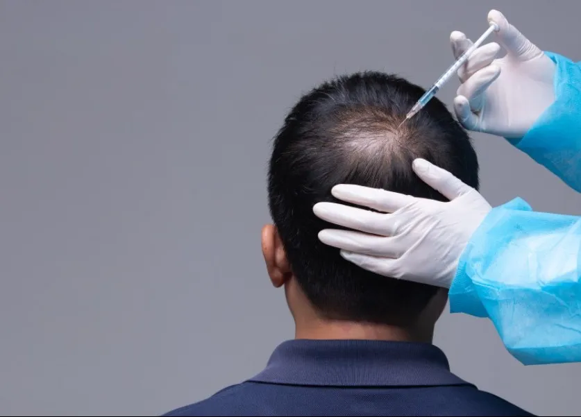 Hair Loss Treatment in Baner Starts With Finding the Cause