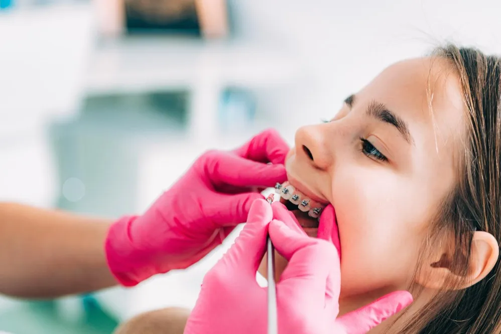 How Orthodontic Care Supports Better Bite Alignment and Dental Health