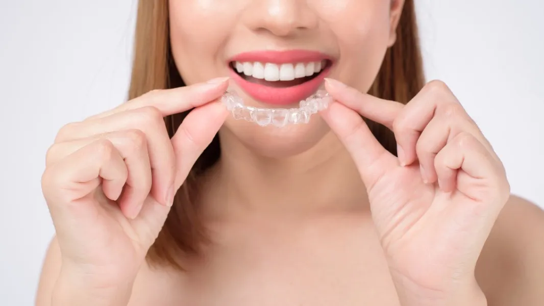 Dental Invisalign in Delhi What Patients Should Know Before Starting Treatment