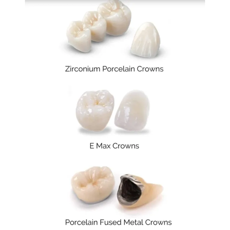 Dental Crown Materials: Which Type of Crown Is Best for Your Teeth?