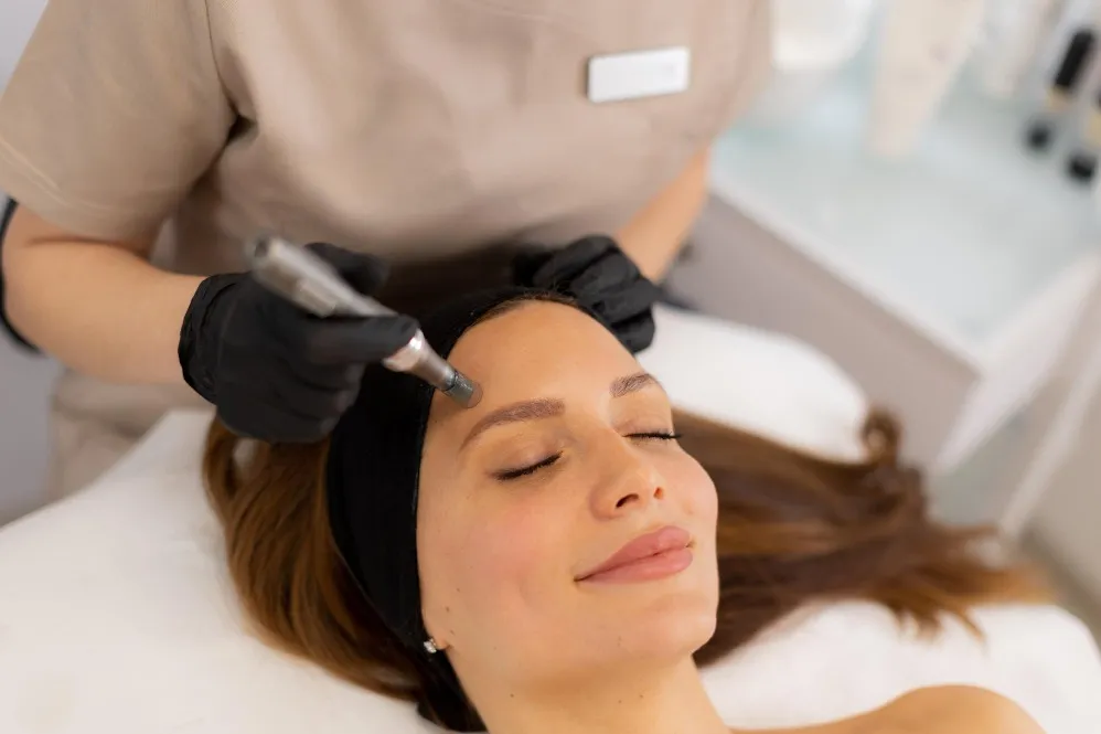 When Microneedling Can Help Acne Scars Texture Fine Lines