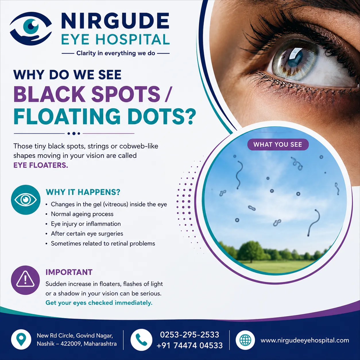 Why Do You See Black Spots in Your Vision?