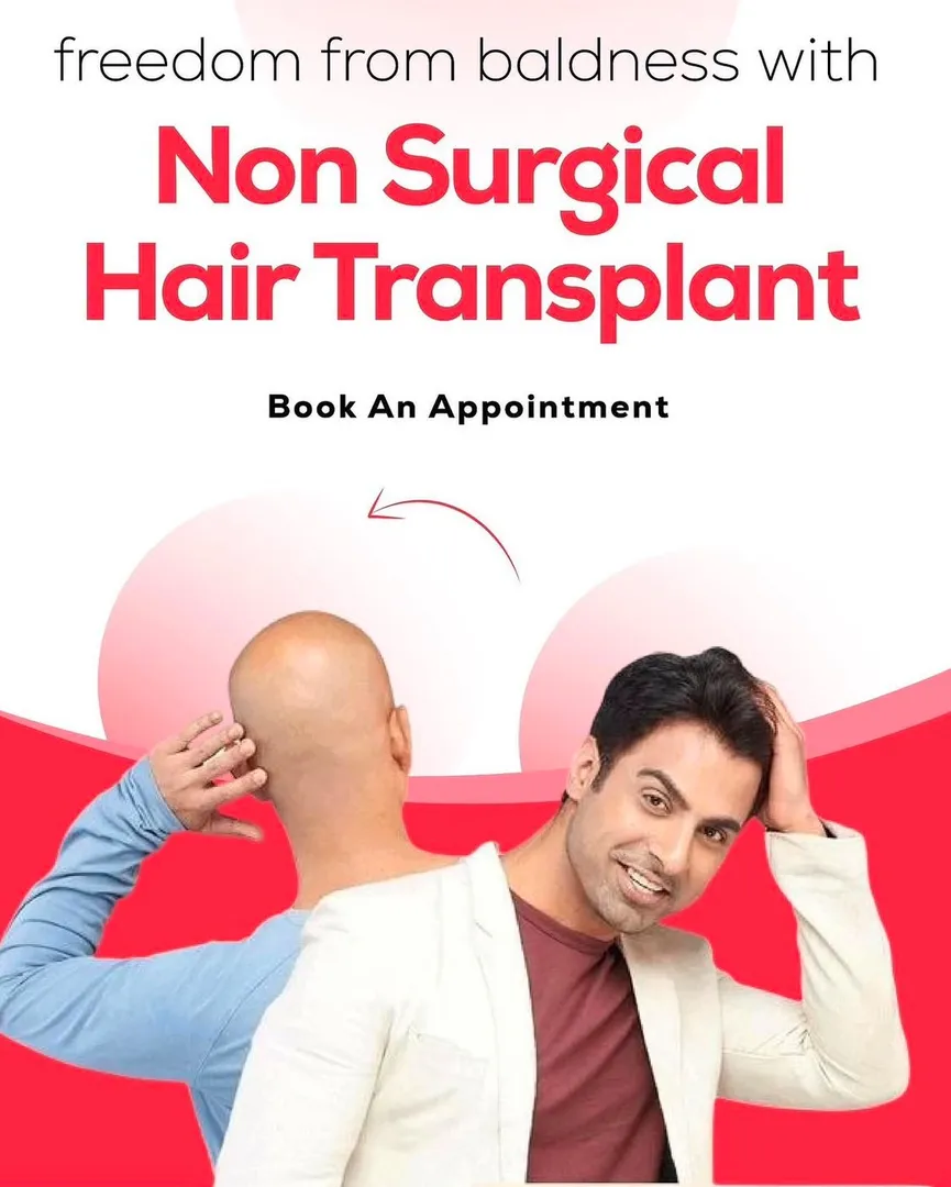 Non Surgical Hair Replacement in Nagpur Who Can Consider It?
