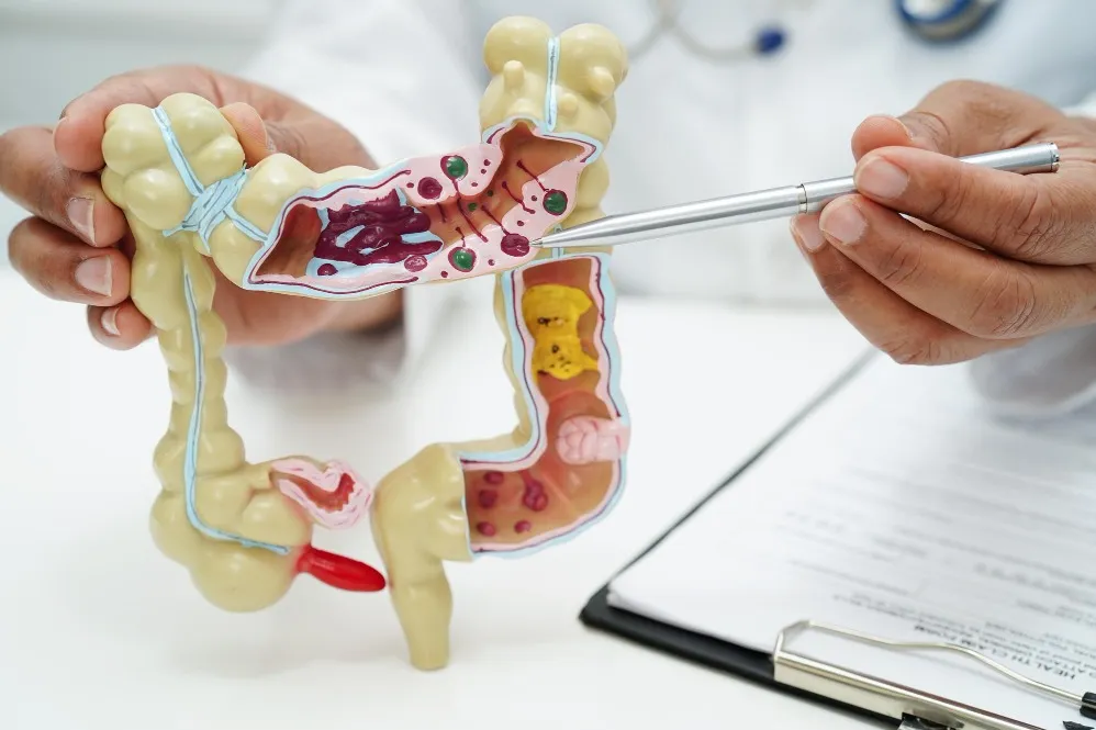 Colorectal Disorders Treatment in Aundh and Symptoms That Need Proper Evaluation