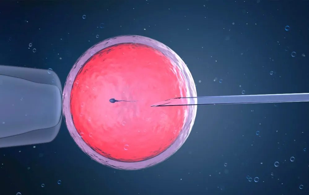 A Complete Guide to IUI Treatment for Couples Beginning Fertility Care
