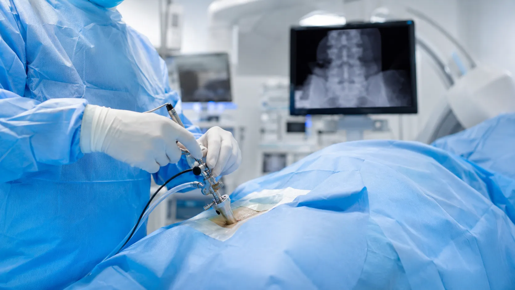 Minimally Invasive Spine Surgery When Is a Smaller Surgical Approach Appropriate