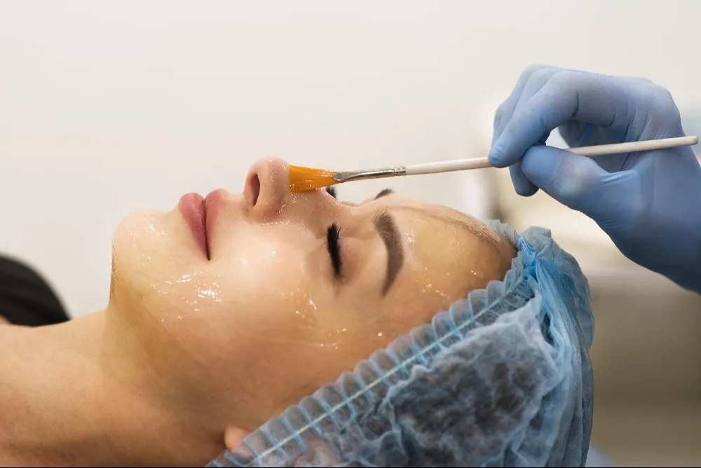 Chemical Peels or Facials Which Is Better for Uneven and Dull Skin