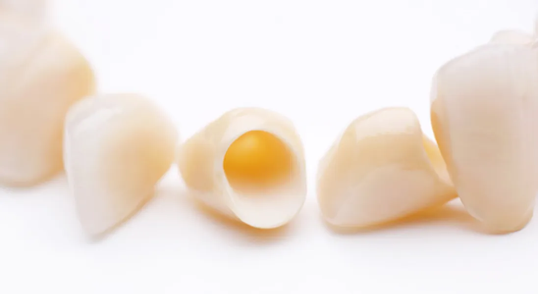 Fully Ceramic Crown Cap in Vadgaon Sheri When Is It Recommended for a Damaged Tooth?