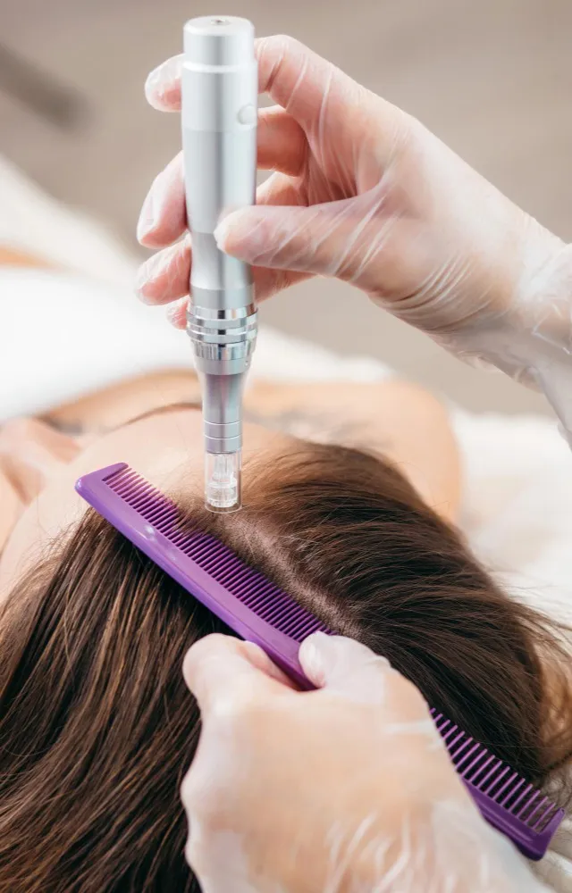 Exosomes for Hair and Face What Patients Should Understand Before Treatment