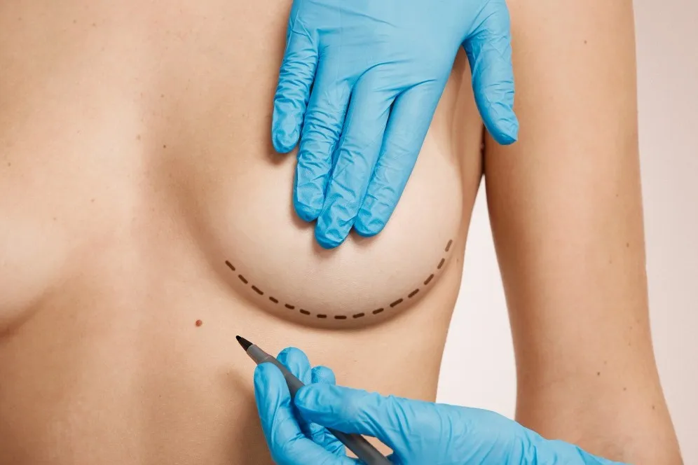 Breast Augmentation in Bengaluru: Understanding Implant Size, Shape and Proportion