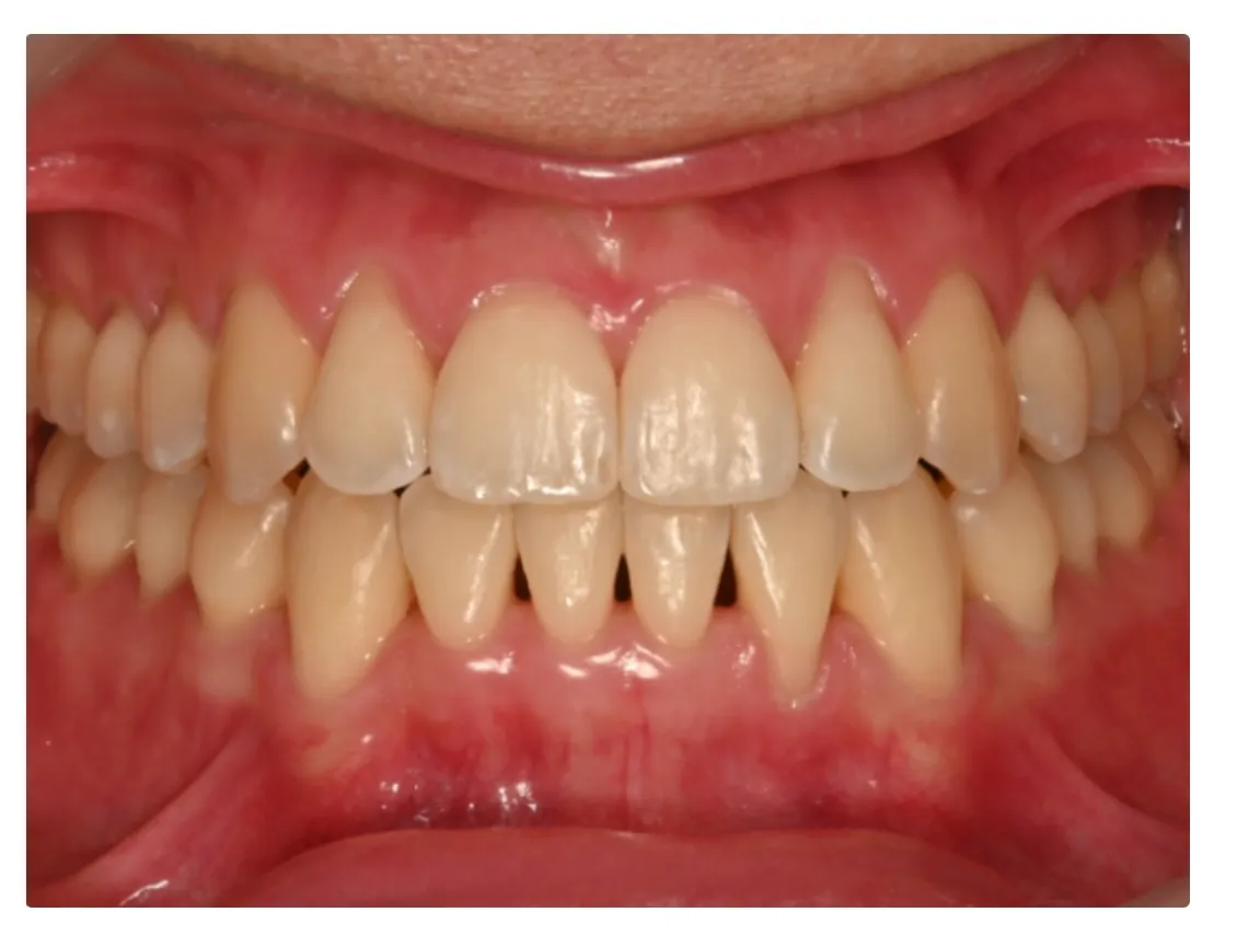 Jaw Pain or Headaches Could Be Related to Your Teeth