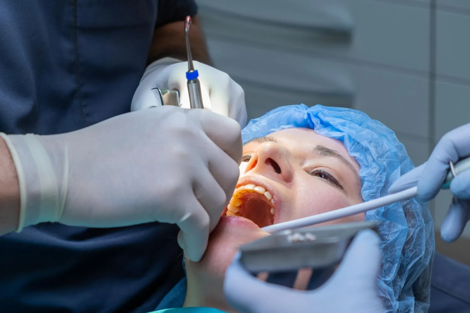 When Periodontal Flap Surgery Becomes Relevant in Advanced Gum Care