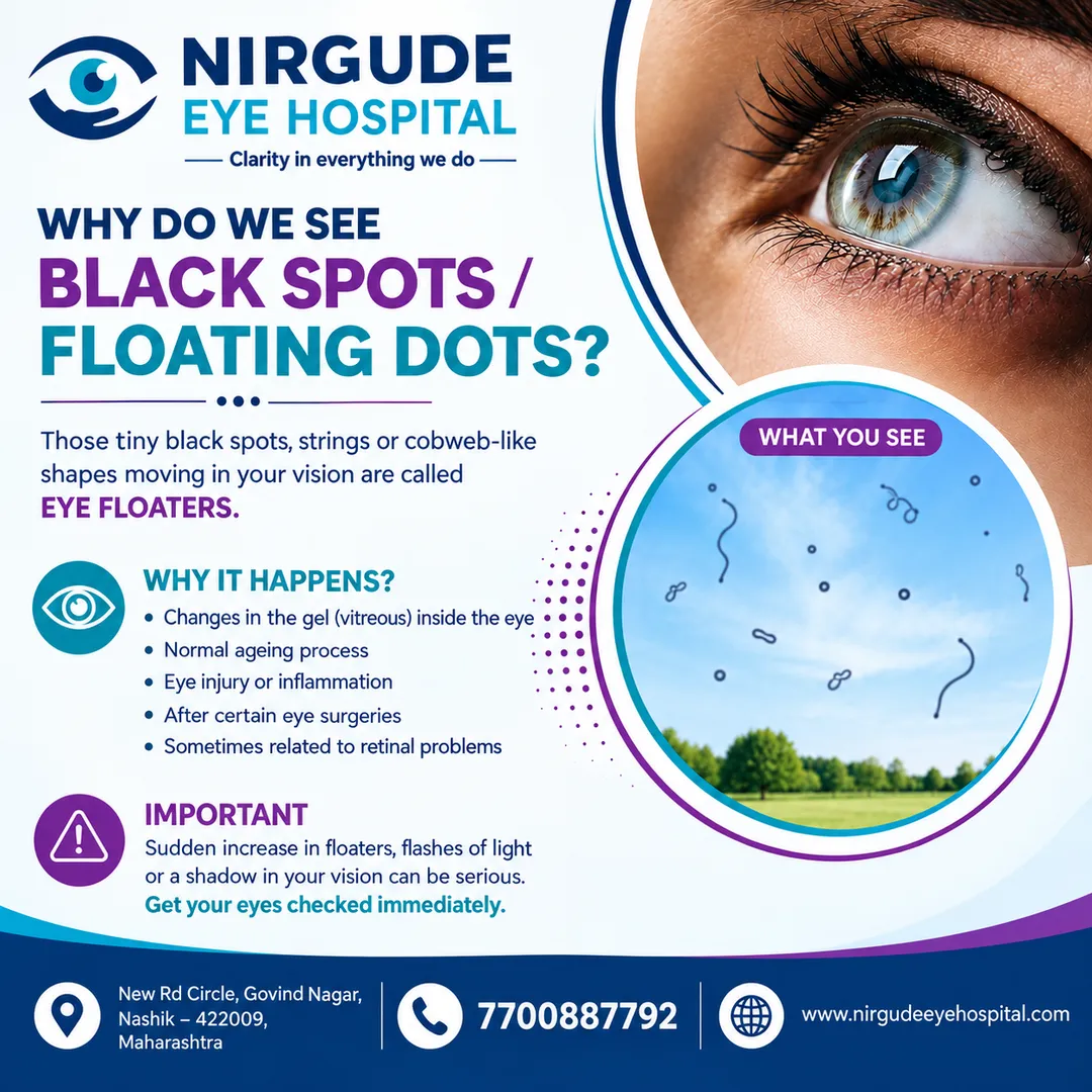 WHY DO WE SEE BLACK SPOTS?