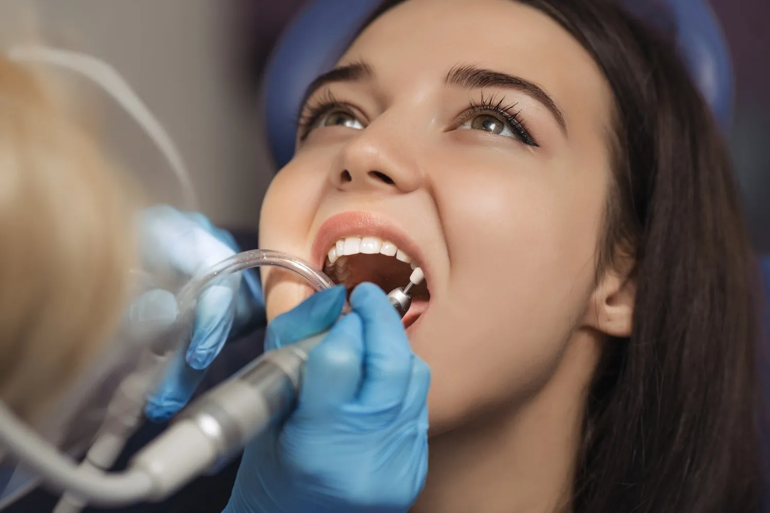 When Teeth Polishing Can Improve Surface Stains and Smoothness