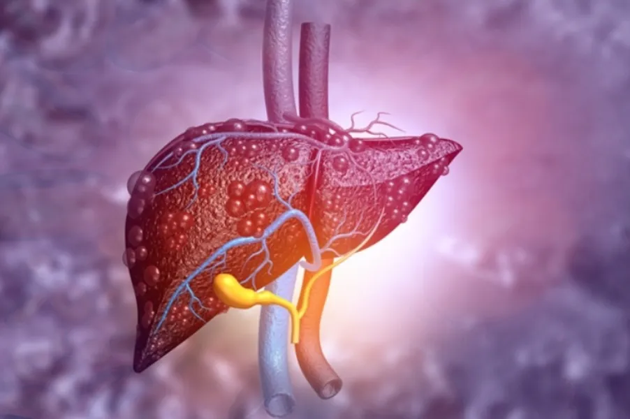 Liver Cancer Specialist in PCMC What Patients Should Know After a Liver Tumour Is Detected