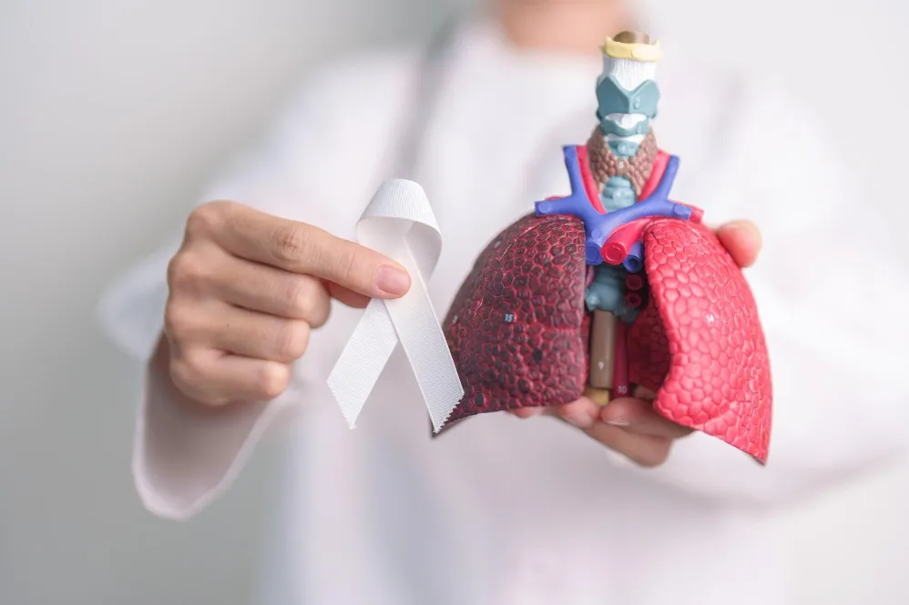 Choosing a Lung Cancer Specialist When a Scan Shows a Suspicious Lung Abnormality