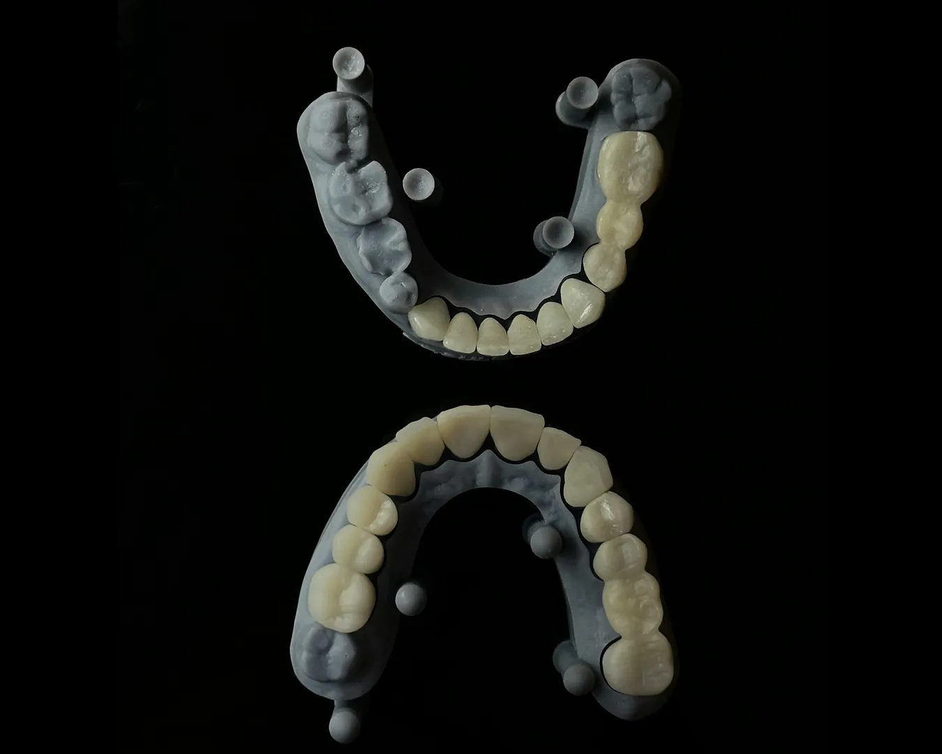 Tooth Cap Near Me In Charni Road Mumbai