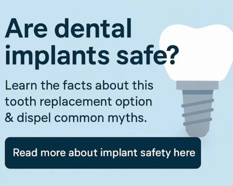 Are Dental Implants Safe? The Scientific Facts You Should Know