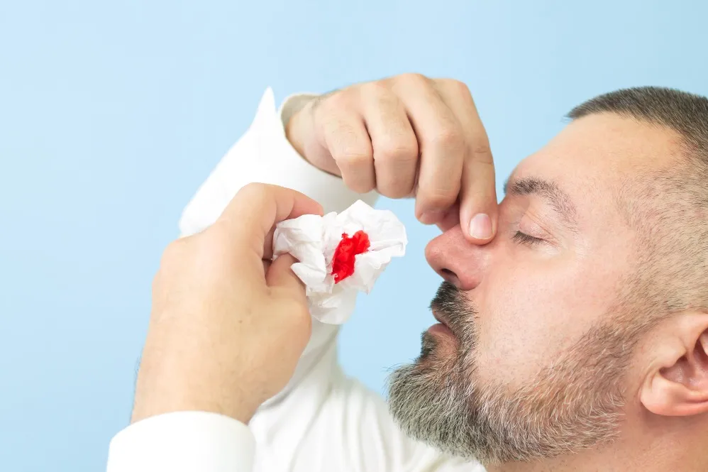 Finding Reliable Nose Bleeding Treatment in Bangalore