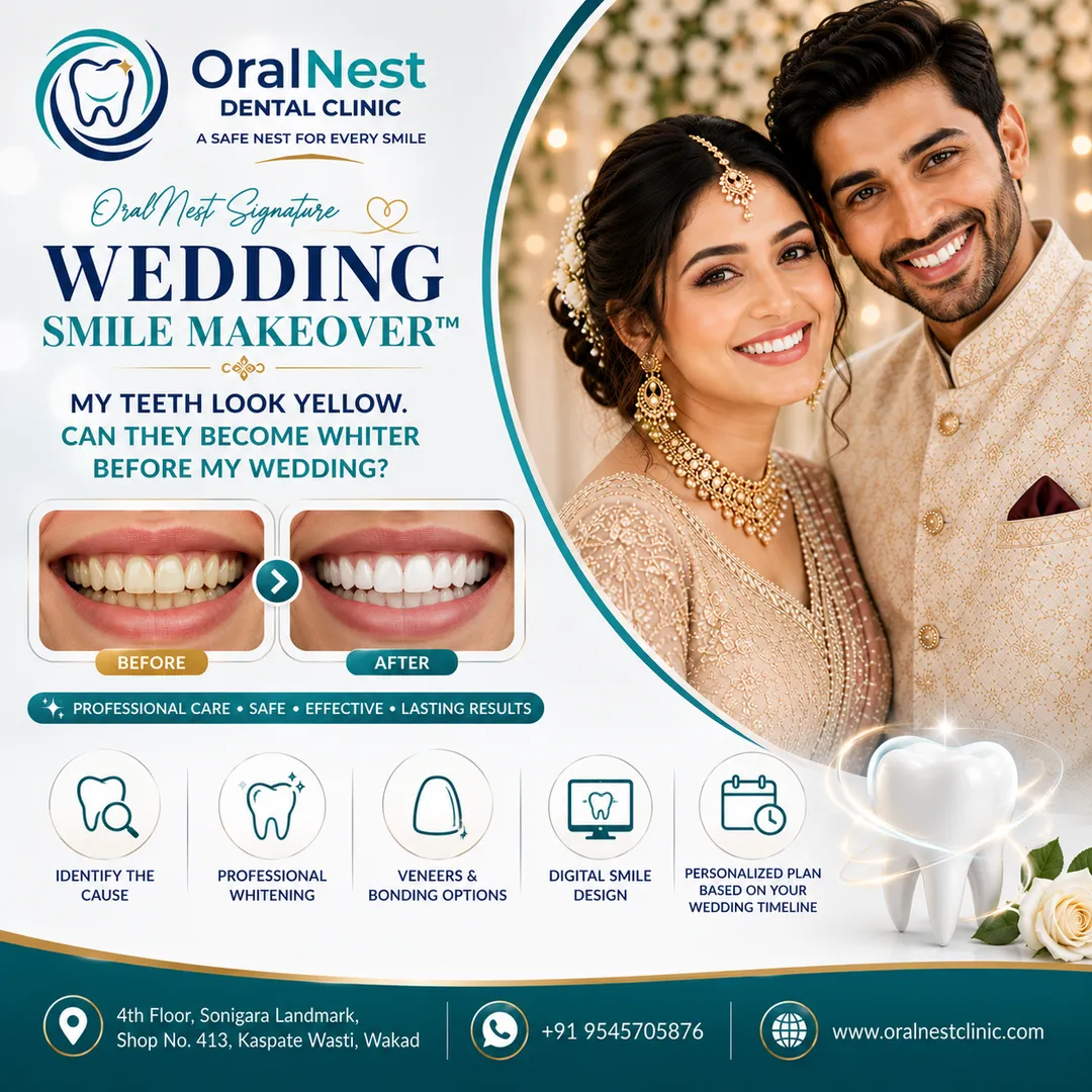My Teeth Look Yellow. Can They Become Whiter Before My Wedding?