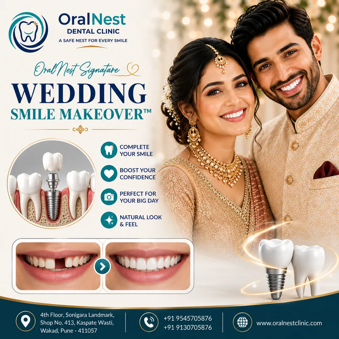 I Have a Missing Tooth. Can I Still Have a Beautiful Wedding Smile?
