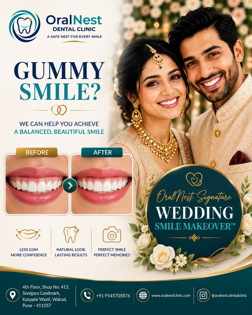 I Show Too Much Gum When I Smile. Can It Be Improved Before My Wedding?