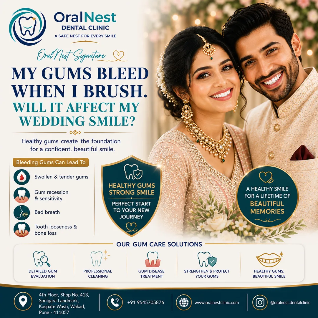 My Gums Bleed When I Brush. Will It Affect My Wedding Smile?