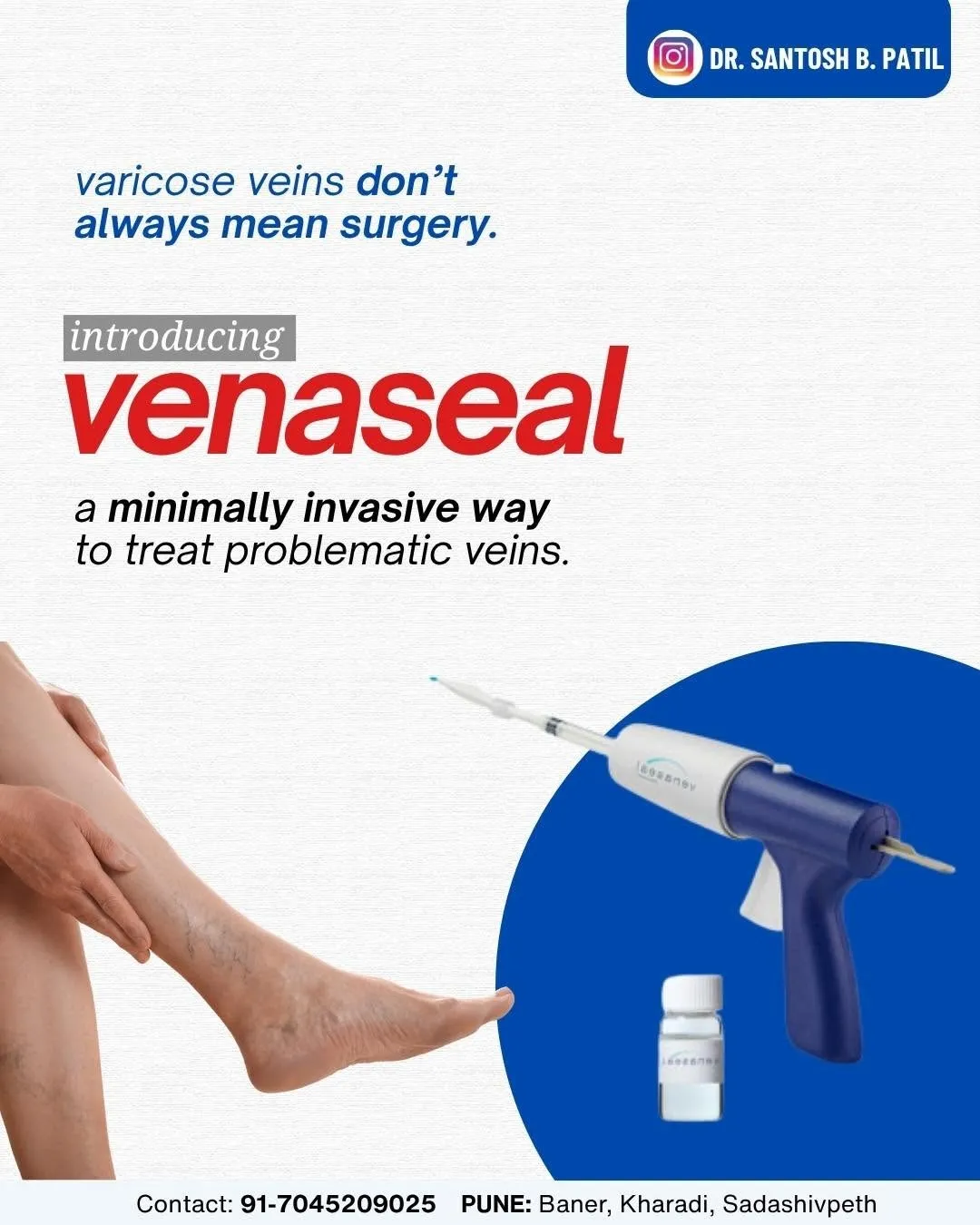 Vascular Surgeon in Pune, Varicose Veins Treatment, VenaSeal Treatment, Minimally Invasive Vein |