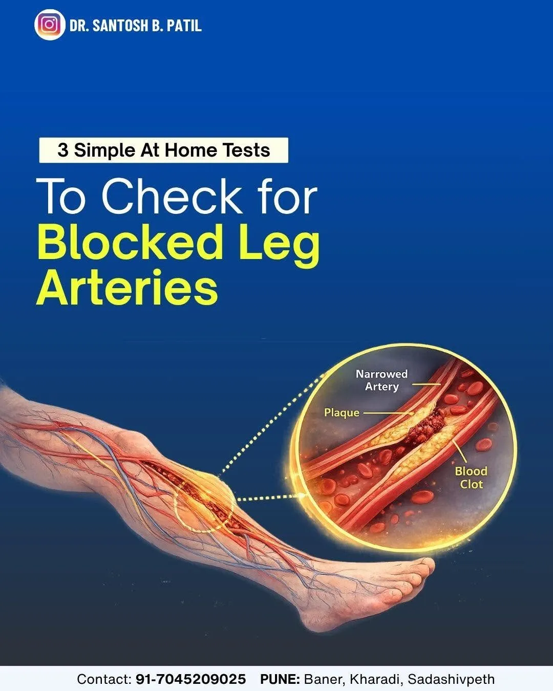 3 Simple At-Home Tests to Check Your Leg Circulation Your legs can sometimes show early signs of red...
