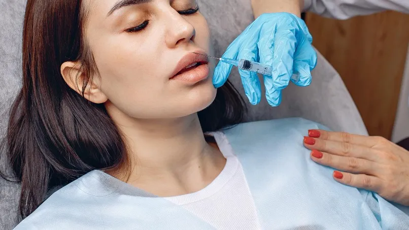 Lip Fillers Explained Results Longevity and Natural-Looking Enhancement