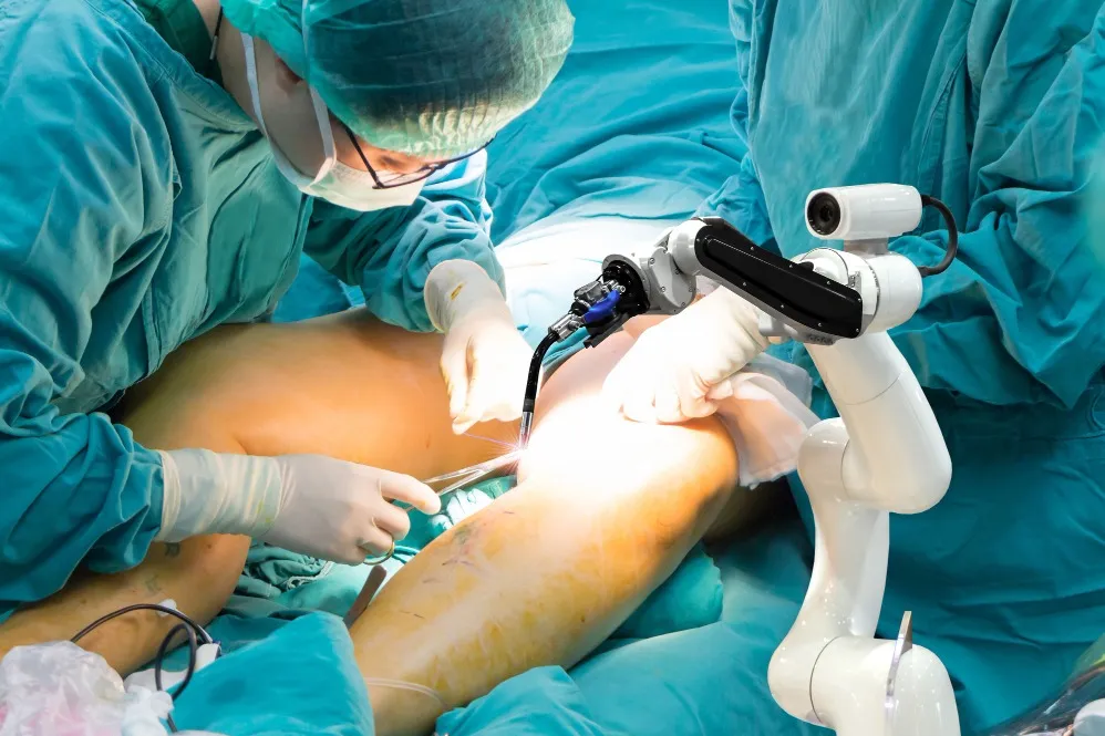 Robotic Knee Replacement How Technology Supports Surgical Planning in Bandra