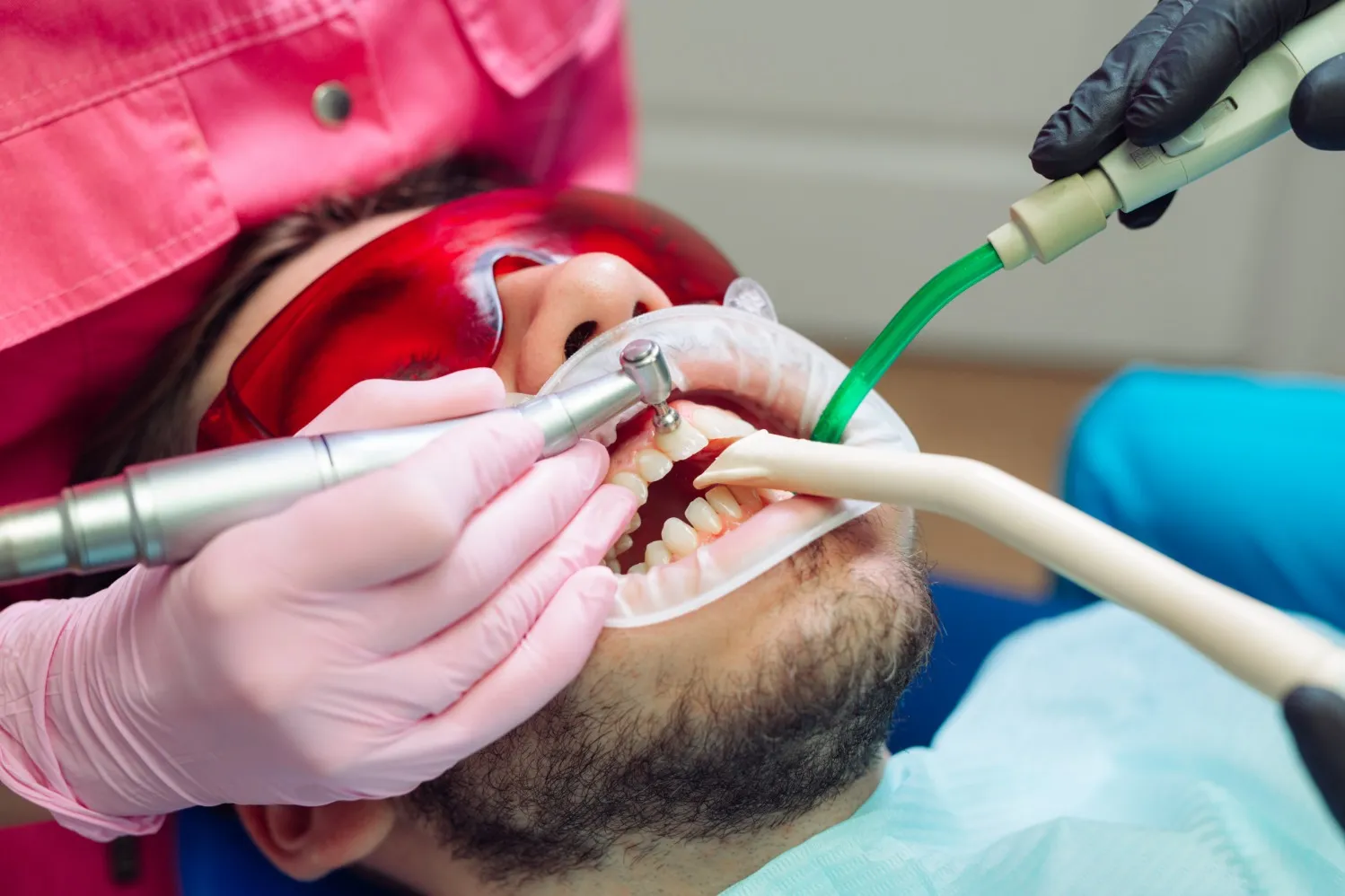 When Professional Teeth Cleaning Becomes Important for Gum Health