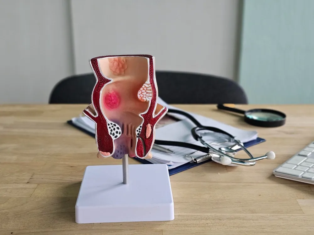 How to Choose a Piles Clinic for Proper Diagnosis and Treatment