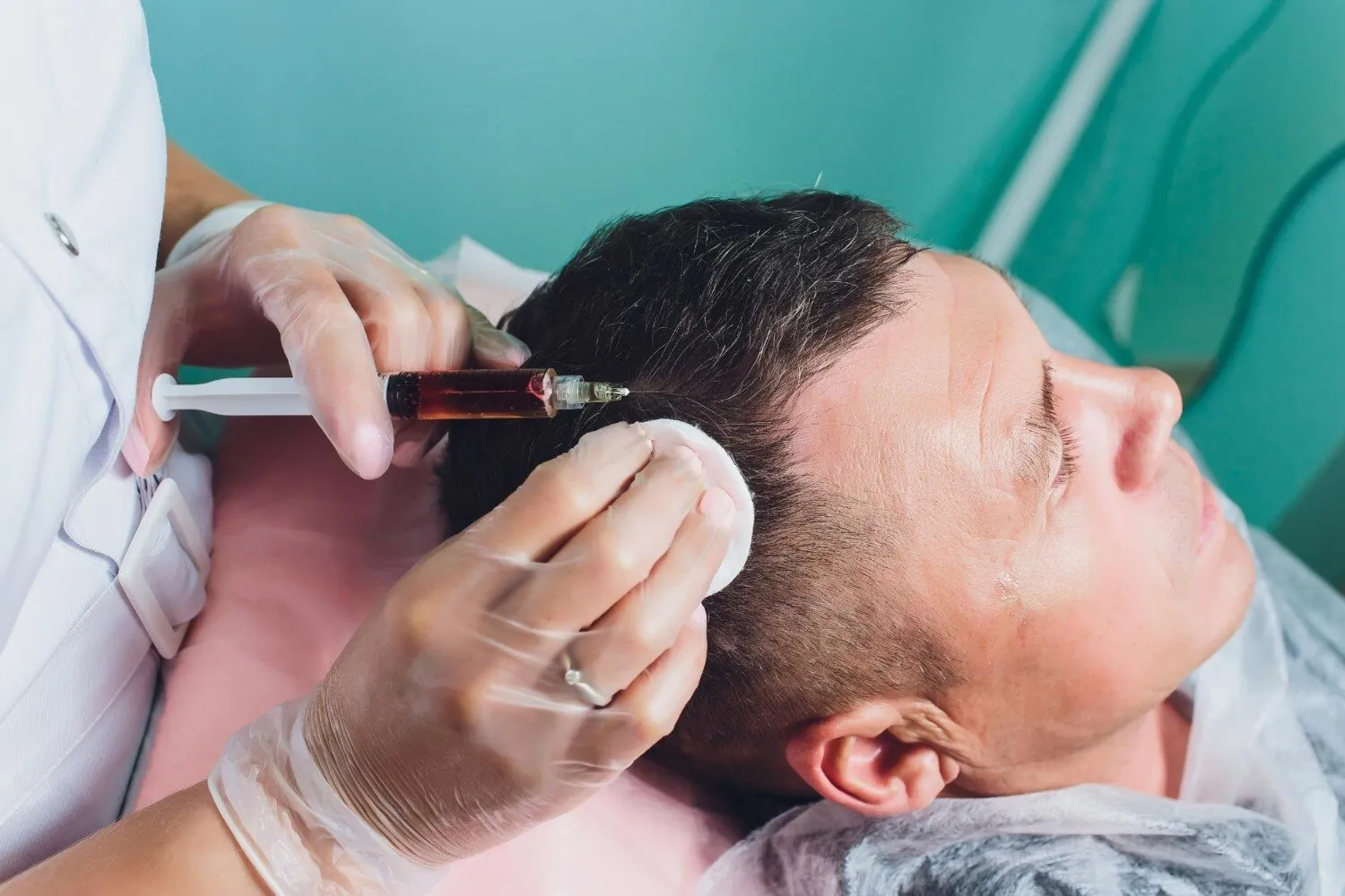 How GFC for Hair Loss May Support Early Hair Thinning Management