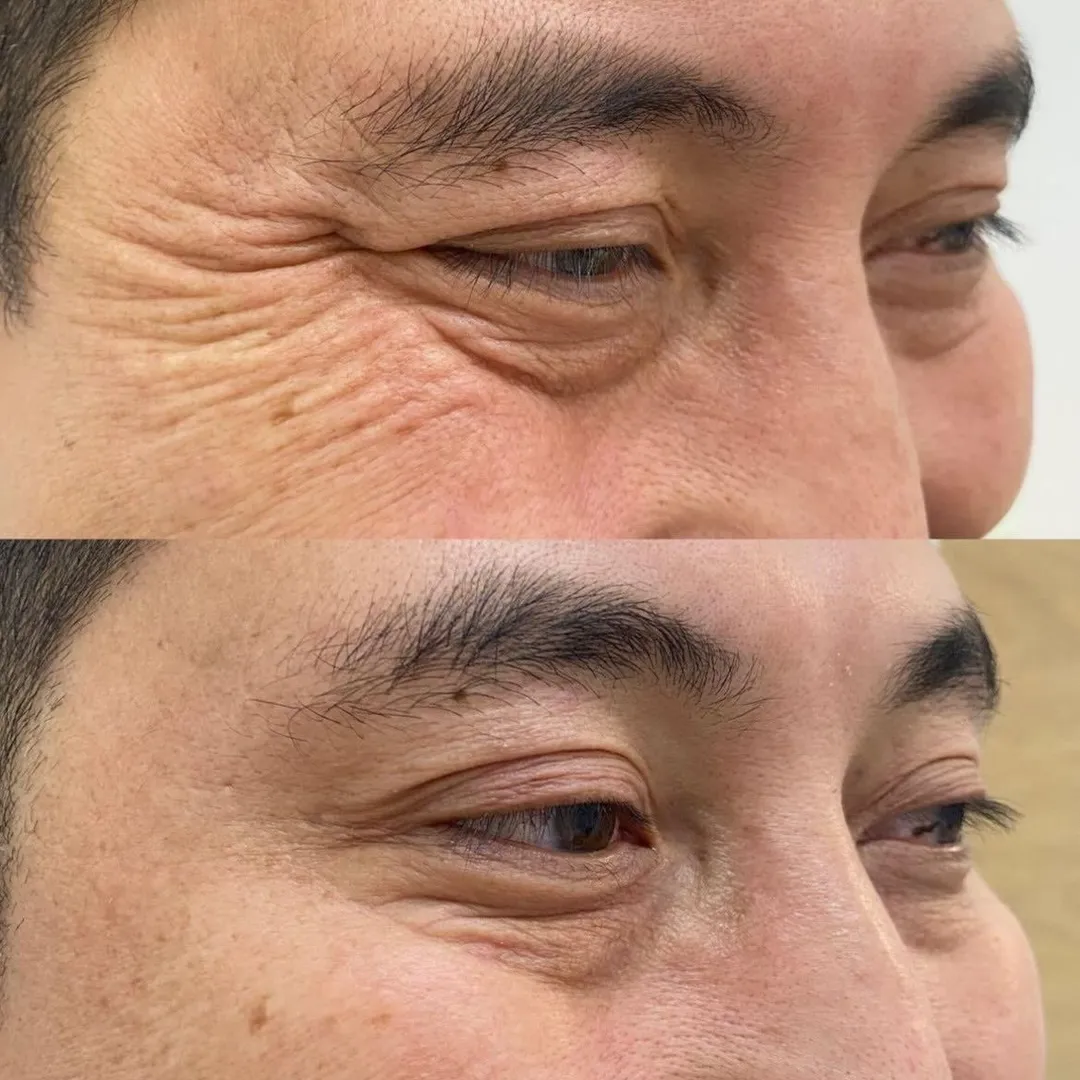 best botox nashik
anti wrinkle treatment nashik
best affordable botox nashik